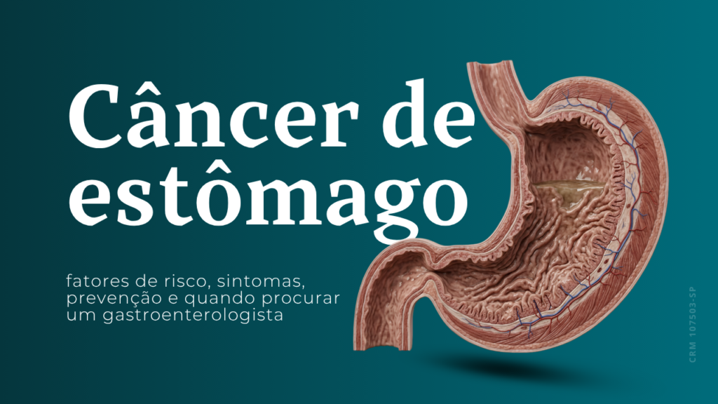 cancer de estomago